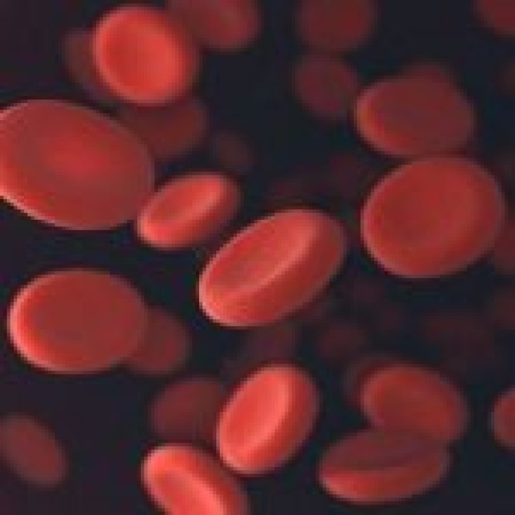 Diretrizes antigas prejudicam tratamento de anemia ferropriva