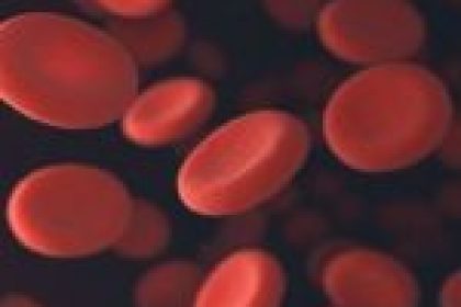 Diretrizes antigas prejudicam tratamento de anemia ferropriva