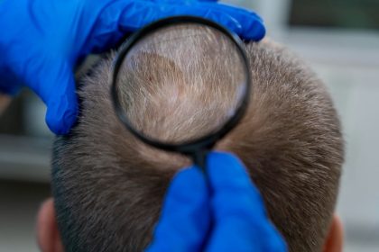 Exame toxicológico por pelos insuficientes: juíza barra eliminação